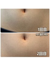 シンバ 倉敷店(SIMBA)/