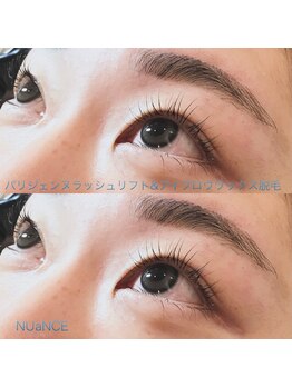 ニュアンス(nuance)/パリジェン+アイブロウ脱毛