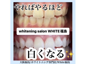 ホワイトニングサロン ホワイト(WHITE)/セルフホワイトニング/大阪/福島