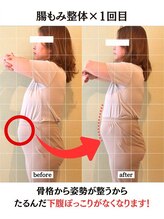 ビーライフ(B Life)/産後のぽっこりお腹も無くなる