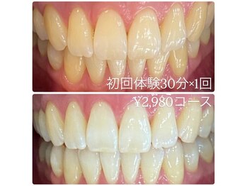 ホワイトニングルーム 川崎店(WhiteningRoom)/ホワイトニング/川崎　