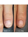 最強のネイルケア3ヶ月コース