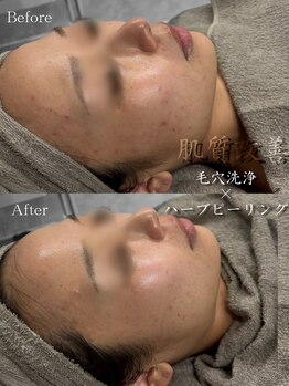 クレビア(CREBIA)/