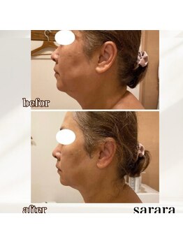 ナチュラル ビューティー スタイル さらさ(Natural Beauty Style)/二重顎改善プログラム