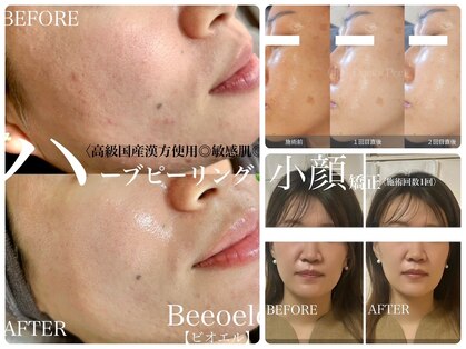 ビオエル(Bee'oele)の写真