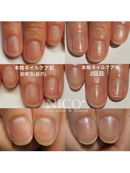 ニコプラス(NICO+)/ジェルネイルができない方向け