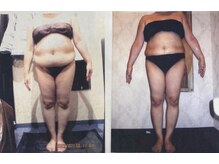 パーフェクトボディプレミアム 大阪梅田店(PERFECT BODY PREMIUM)/お客様　ビフォーアフター（3）