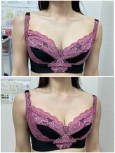 バーディー(BIRDIE)/施術１回/3０代