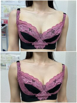 バーディー(BIRDIE)/施術１回/3０代