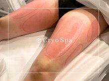 クリオスパ 豊春店(Cryo Spa)/脂肪冷却後