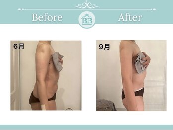 美人バスト 掛川店/痩身症例