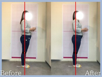 トロ整骨院(toro整骨院)/骨盤矯正★1回の効果★30代女性