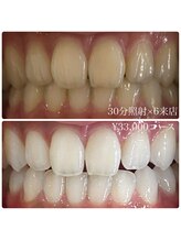 ホワイトニングルーム 川崎店(WhiteningRoom)/ホワイトニング/川崎　