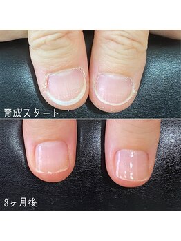 ネイルズ アヴァンティ(Nails Avanti)/最強のネイルケア3ヶ月コース