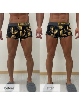 ヴィーナス(Venus)/スタッフ痩身/下半身カット出し