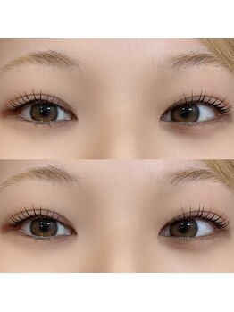 シュシュ(chou chou)/まつ毛パーマ/ラッシュリフト