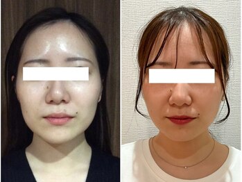 美容整体 ウェリナ 蟹江院/小顔矯正/骨盤矯正/美脚サロン