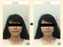 コロナ整体 神宮前院(Corona.整体)/小顔 Before&After〈原宿/小顔〉