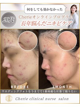 シェリー(Cherie)/結婚式に一番綺麗な自分でいたい