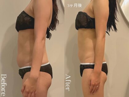 ユーフォリア グロウ(euphoria glow)の写真