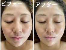 ナオフクオカ ヒーリングフォースエヌ(NaoFukuoka/healingforceN)/ストレスに負けない強い肌へ！