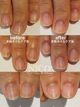 ニコプラス(NICO+)/ジェルネイルができない方向け