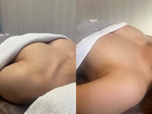 リングケー(Ling K)/バストアップ