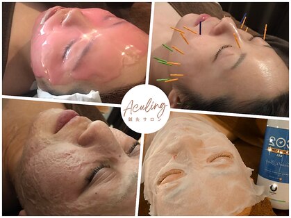 アキュリング(Aculing)の写真