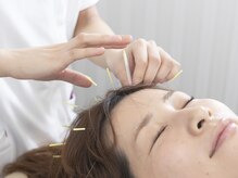 ブレア 銀座/施術写真【自律神経/虎ノ門/鍼】