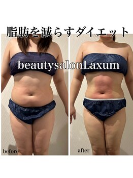 ビューティーサロン ラグジューム(Beauty salon Laxum)/お腹の脂肪、減らしましょう！