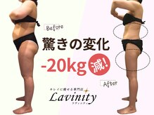 ラヴィニティ 大宮店(Lavinity)