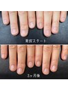 最強のネイルケア3ヶ月コース