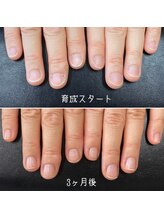 ネイルズ アヴァンティ(Nails Avanti)/最強のネイルケア3ヶ月コース