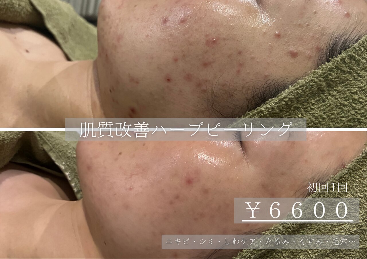 お肌をきれいにしたい！安佐南区・安佐北区で人気のエステ,脱毛,痩身