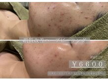 エステティック バイ マルキーズ(ESTHETIC by marquise)