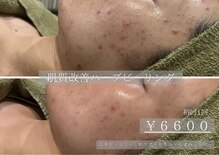 エステティック バイ マルキーズ(ESTHETIC by marquise)