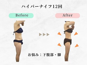 美容整体ウェリナ あま甚目寺院/小顔矯正/骨盤矯正/美脚サロン