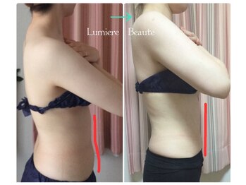 リュミエールボーテ/ブライダルキャビテーション