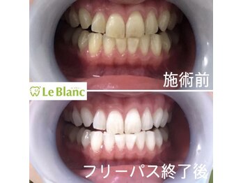 ルブラン 奈良店(Le Blanc)/効果には個人差がございます!