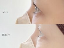 ルメア(LUMEA)の雰囲気（年齢とともに変化する瞼、エクステからパーマ変更もご相談下さい）