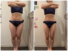 鈴木整体院 仙台泉院/小顔造顔/骨盤矯正/痩身整体