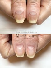 マリーロール 淀屋橋本店(Marie Laure)/自爪育成/深爪矯正/ネイルケア