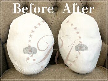 R-1ビューティーサロン 表参道/Before &After(6回)