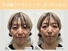 リマナ(Limana)の雰囲気（40代女性/立体造顔美容鍼(お悩み:ほうれい線、むくみ、たるみ)）