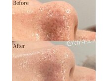 フォルチェ ゆめタウン広島店(Folche)