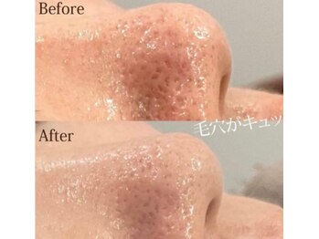 フォルチェ ゆめタウン広島店(Folche)