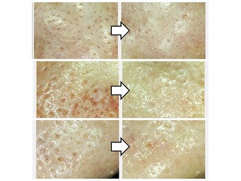 サロン ド ボーテ プルーラ(Salon de beaute PLURA)/こんな風に改善します