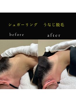 ラティ/シュガーリング