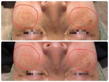 リズベット(LIZ BET)/諦めていた目元や鼻上も◎