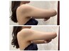 【業界激震!】超最新!切らない1day脂肪分解☆両二の腕120分75000→39600円